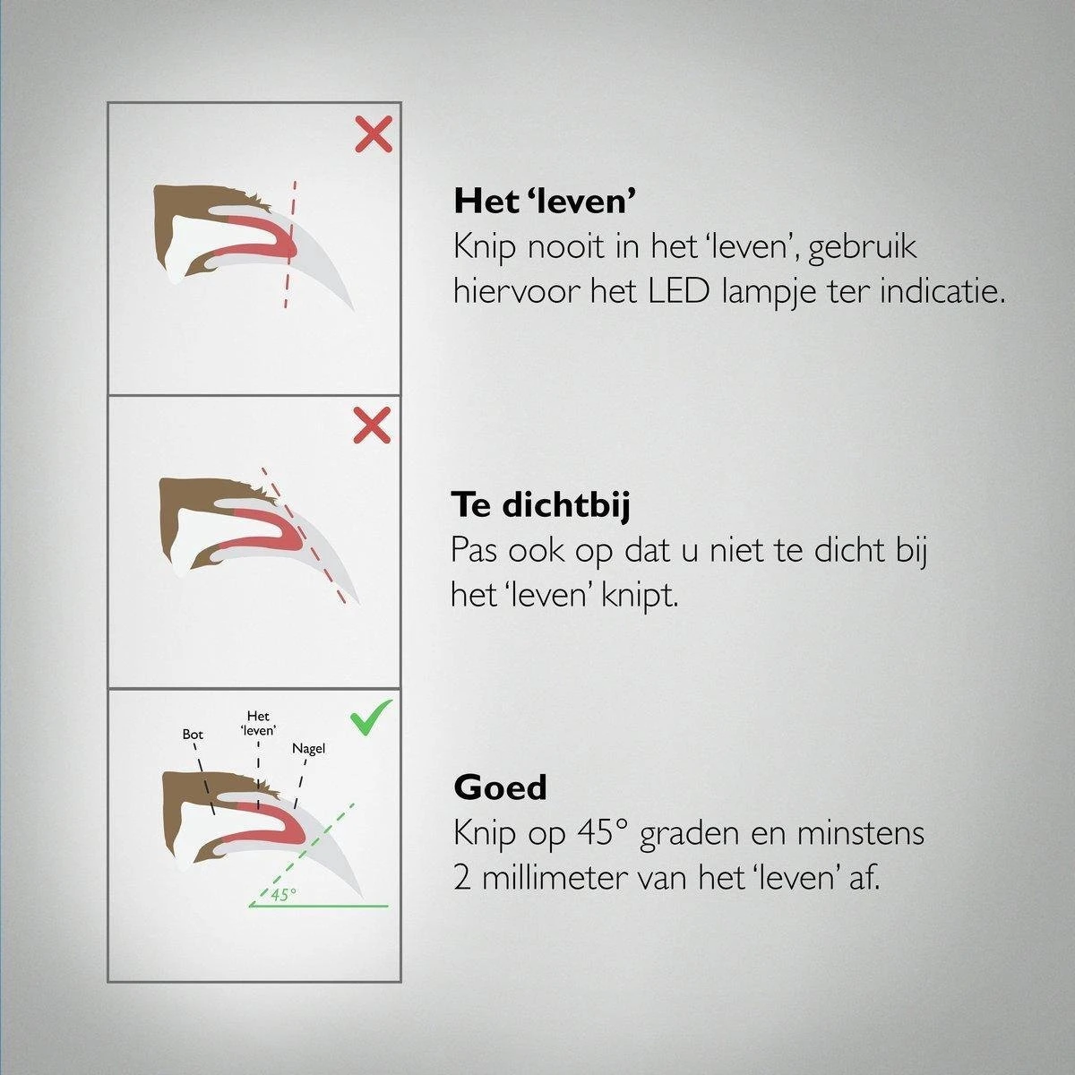 Professionele Oplaadbare LED Licht Nagelknipper, Hond, Kat, Knaagdier, Huisdieren | Dog, Cat, Nail Clipper LED Light, Rechargeable, USB Kabel | Nagelvijl - Nagelschaar Met Vijl, Opvang Van Nagels | Vergrootglas 5x | Extreem Veilig & 100% Effectief 5 Professionele Oplaadbare LED Licht Nagelknipper, Hond, Kat, Knaagdier, Huisdieren | Dog, Cat, Nail Clipper LED Light, Rechargeable, USB Kabel | Nagelvijl - Nagelschaar Met Vijl, Opvang Van Nagels | Vergrootglas 5x | Extreem Veilig & 100% Effectief - Afbeelding 5